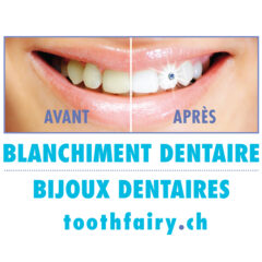 TOOTH FAIRY BLANCHIMENT ET BIJOUX DENTAIRES